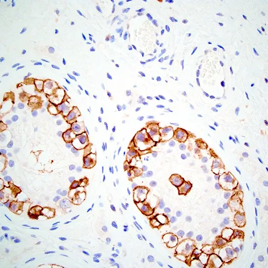 IHC - Cluster of Differentiation 117 (CD117)